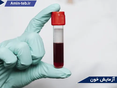 آزمایش خون از آزمایشات اصلی طب کار میباشد